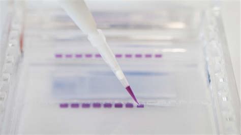 direct loading of gels|Gels .